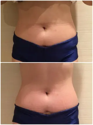 シルクロード 越谷店のエステ・リラクイメージ