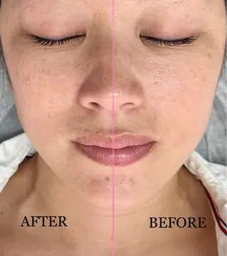 医療提携美容サロン Beatriceのエステ・リラクイメージ