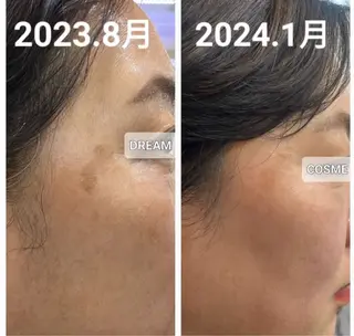 Ranan kazuのマツエク・マツパデザイン