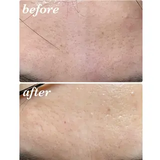 結果重視｜毛穴エステ ｜友綱理恵のエステ・リラクイメージ