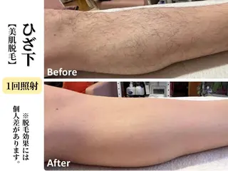 本格痩身＊透明美肌 BelleWhiteのエステ・リラクイメージ