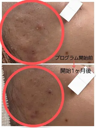 上尾Luce. あきやまのエステ・リラクイメージ