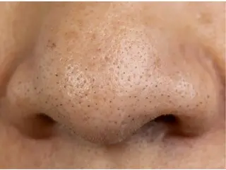 REBORN 赤井愛美のエステ・リラクイメージ