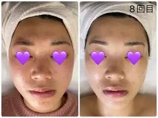 COCO beautyサロンのエステ・リラクイメージ