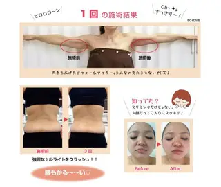 ミディアム パーマ ネイル マツエク・マツパ 小顔矯正・美容鍼 美鍼堂のエステ・リラクイメージ