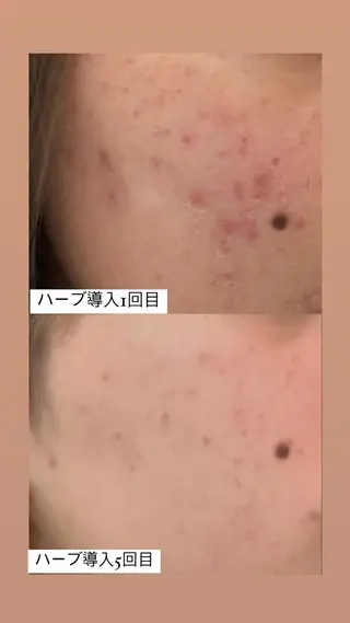 トータルビューティ サロンstageのエステ・リラクイメージ