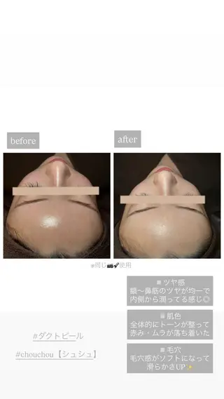 シュシュ／ hayasaのその他イメージ