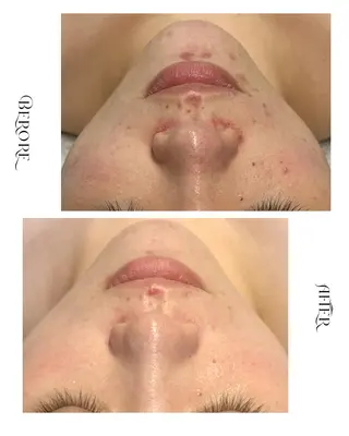 脱毛・肌質改善サロン Linoのエステ・リラクイメージ