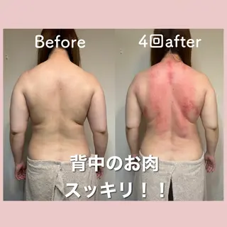 小顔矯正専門店Gémiey所属・越谷駅徒歩３分 小顔専門Gemieyのエステ・リラクイメージ