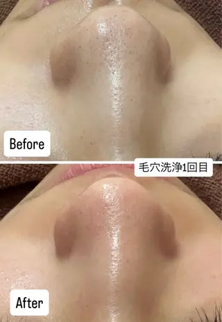 韓国肌管理×毛穴 改善専門🤍nanaのエステ・リラクイメージ