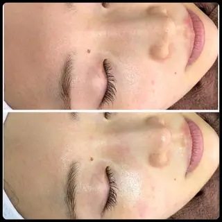 メンズ 医療提携美容サロン Beatriceのエステ・リラクイメージ