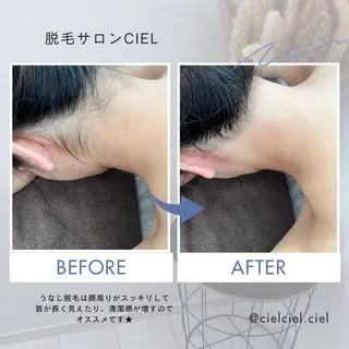 脱毛サロン CIELのエステ・リラクイメージ