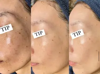 パーソナルスキンケア 🦋APRI🅿️有のエステ・リラクイメージ