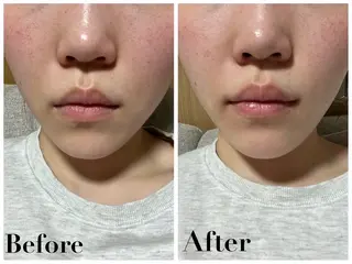 Alluring アルーリング中村のエステ・リラクイメージ