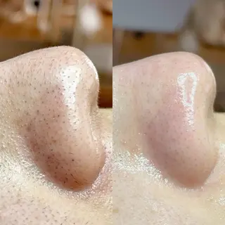 毛穴・頭皮 専門店💪のその他イメージ