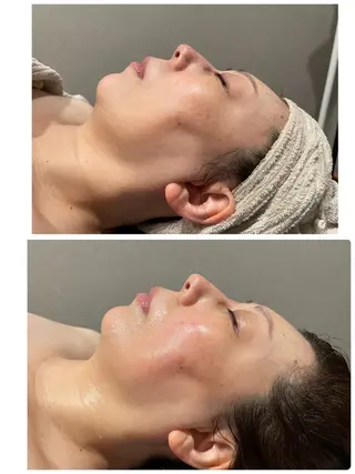 エステ／ネイル/脱毛 R.Msalonのネイルデザイン