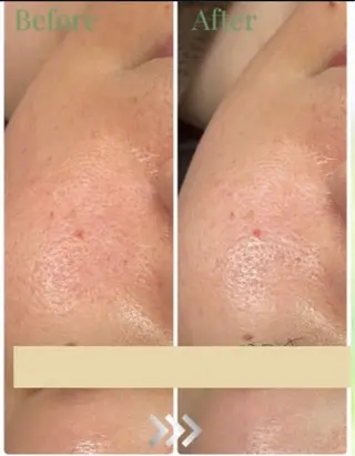 bonuru salonのエステ・リラクイメージ