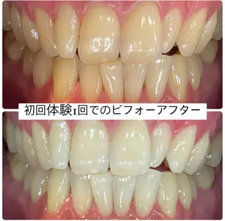 ホワイトニングルーム 横浜店のその他イメージ