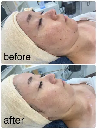 Toujours トゥジュールのエステ・リラクイメージ