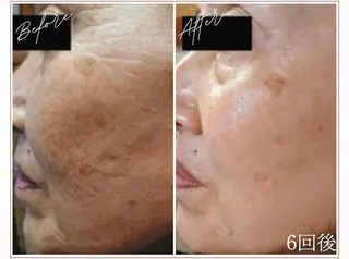 MYubelle ミューベルのエステ・リラクイメージ