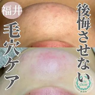 毛穴肌質ケアサロン Yourmeユアミーのエステ・リラクイメージ