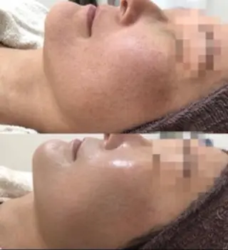 痩身専門サロン マハロミのエステ・リラクイメージ