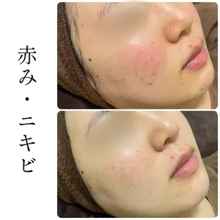 ハーブピーリング専門 BIOEL横浜のエステ・リラクイメージ