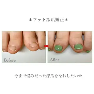 ネイル ネイルサロン アリュームのネイルデザイン