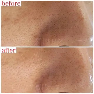 毛穴ケア専門サロン レーヌのエステ・リラクイメージ