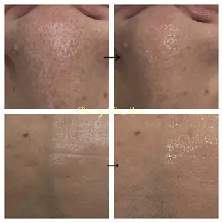 ビューティー ミロワールのエステ・リラクイメージ