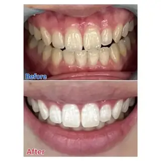 M渋谷 ホワイトニングのエステ・リラクイメージ