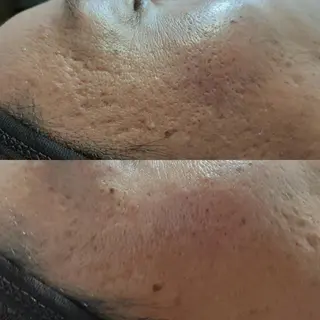 マツエク・マツパ eyelash e'nのネイルデザイン