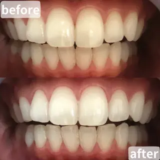 LBSホワイトニング 桶川店のエステ・リラクイメージ