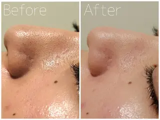 毛穴/肌管理/痩身/ ボディケア/satoのエステ・リラクイメージ