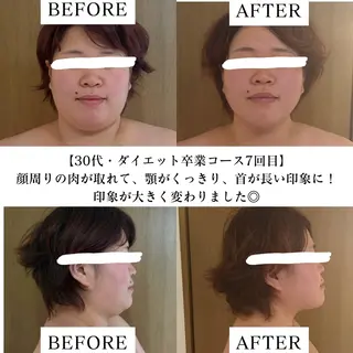 【目黒】本格痩身✴︎ 最新型よもぎ蒸しのエステ・リラクイメージ