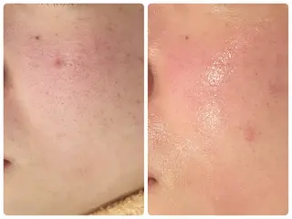 total beauty TLIENGLE［ﾄﾘｱﾝｸﾞﾙ］所属・tliengle ［ﾄﾘｱﾝｸﾞﾙ］のネイルデザイン