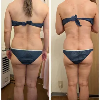 Malie プライベートサロンのエステ・リラクイメージ