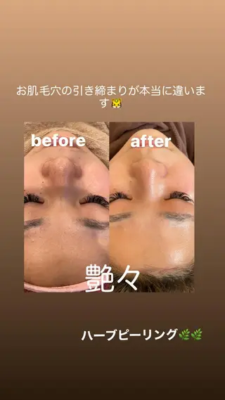 VERY VERY 九条店のエステ・リラクイメージ