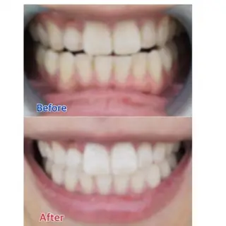 Ｍ渋谷 ホワイトニングのエステ・リラクイメージ