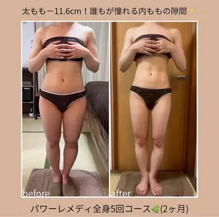 《本気痩せ×疲労改善 》  BILOOPのエステ・リラクイメージ