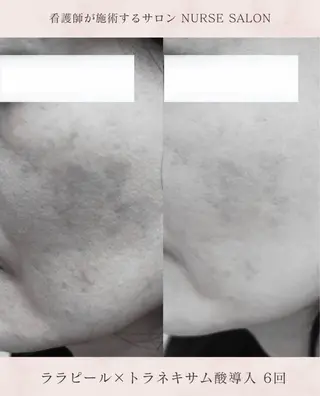 🌟看護師が施術🪄 ナスサロ/狩野のエステ・リラクイメージ