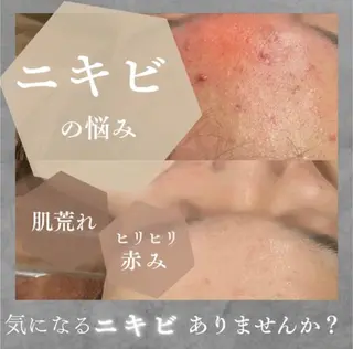 ベリールルヴィ ベリールルヴィのエステ・リラクイメージ