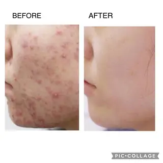 SMOOTH SKIN SPA.のエステ・リラクイメージ