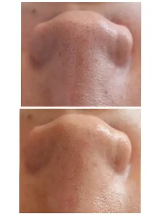 エステサロン NICOLIのエステ・リラクイメージ