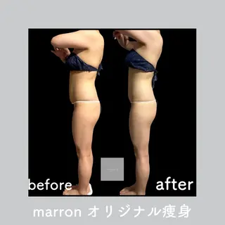 marron所属・痩身ハイパーナイフ ララピールリアボーテのエステ・リラクイメージ