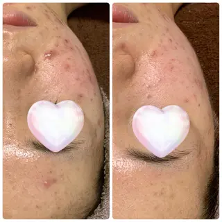 M.riche エムリシェのエステ・リラクイメージ