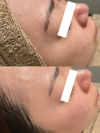 ビューティーサロン Lino🫧mayuのエステ・リラクイメージ