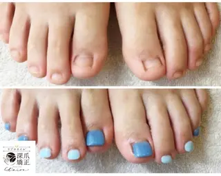 メンズ ネイル 深爪矯正専門店　ネイルサロン　トイロ所属・ネイルサロン トイロのネイルデザイン