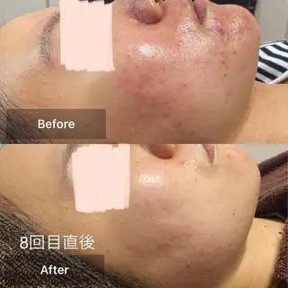 メンズ キッズ 美肌と癒しのサロン Lu,Mieのエステ・リラクイメージ