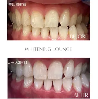 ホワイトニング Lounge横須賀のエステ・リラクイメージ